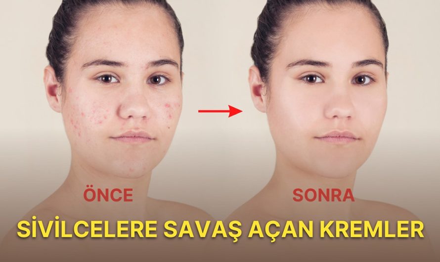 Zynert Krem Ne işe Yarar? Sivilceye Etkileri, Kullanıcı Yorumları